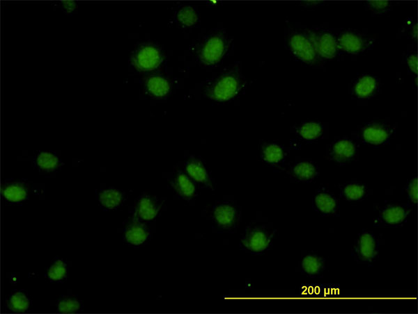 TOPORS Antibody - Immunofluorescence of monoclonal antibody to TOPORS on HeLa cell (antibody concentration 10 ug/ml).