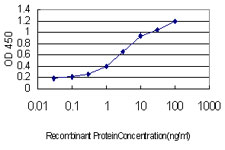 TOPORS Antibody - Detection limit for recombinant GST tagged TOPORS is approximately 0.1 ng/ml as a capture antibody.