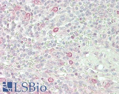 TOR1AIP1 / LAP1 Antibody - Human Spleen: Formalin-Fixed, Paraffin-Embedded (FFPE)