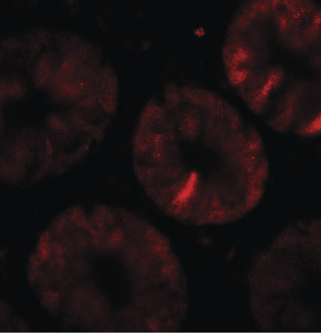 TOX Antibody - Immunofluorescence of TOX in human colon tissue with TOX antibody at 20 ug/ml.