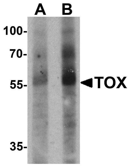 TOX Antibody - Western blot analysis of TOX in human colon tissue lysate with TOX antibody at (A) 1 and (B) 2 ug/ml.