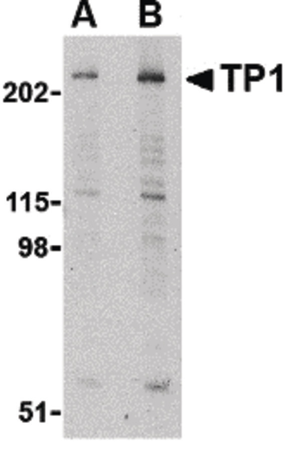 TP1 / TEP1 Antibody - Western blot of TP1 in human kidney tissue lysate with TP1 antibody at (A) 1 and (B) 2 ug/ml.