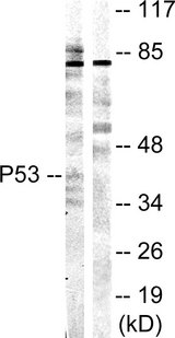 TP53 / p53 Antibody - Western blot analysis of lysates from COS7 cells, treated with UV 5', using p53 Antibody. The lane on the right is blocked with the synthesized peptide.