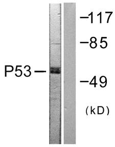 TP53 / p53 Antibody - Western blot analysis of lysates from 293 cells, treated with Etoposide 25uM 60', using p53 Antibody. The lane on the right is blocked with the synthesized peptide.