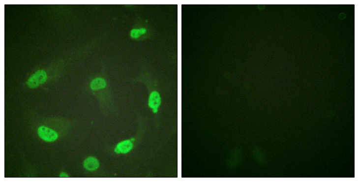 TP53 / p53 Antibody - Immunofluorescence analysis of HeLa cells, using p53 (Acetyl-Lys379) Antibody. The picture on the right is blocked with the synthesized peptide.