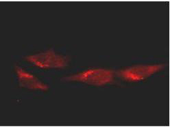 TP53 / p53 Antibody - p53 Antibody - Immunofluorescence Microscopy. Immunofluorescence microscopy of HeLa cells using anti-p53. Protein A purified Mab anti-p53 was used at a 1:100 dilution in 10% normal goat serum in PBS and reacted overnight at 4° C. After washes cells were incubated with a 1:500 dilution of Alexa Fluor594 Goat-a-Mouse IgG diluted in normal goat serum for 1 h at room temperature. Personnel Communication. Kuldeep Patel, Loyola University.
