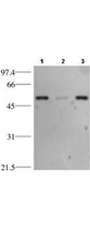TP53 / p53 Antibody - p53 Antibody - Western Blot. Western blotting using anti-p53. HeLa whole cell lysate (lane 1), cytosol fraction (lane 2) and nuclear extract (lane 3) (15 ug) were separated by 10% SDS-PAGE and transferred to nitrocellulose membrane. The membrane was blocked with 3% milk/TBST for 1 h at room temperature followed by incubation with Protein A purified Mab anti-p53 overnight at 4° C diluted 1:1500 in blocking solution. The membrane was washed 3X with TBST and then incubated with a 1:2000 dilution of HRP Goat-a-Mouse IgG diluted in blocking buffer for 1 h at room temperature. After final washes the proteins reactive on the membrane were detected using ECL. Other detection systems will yield similar results. Personnel Communication. Kuldeep Patel, Loyola University.