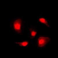 TP53 / p53 Antibody - Immunofluorescent analysis of p53 (pS20) staining in HCT116 cells. Formalin-fixed cells were permeabilized with 0.1% Triton X-100 in TBS for 5-10 minutes and blocked with 3% BSA-PBS for 30 minutes at room temperature. Cells were probed with the primary antibody in 3% BSA-PBS and incubated overnight at 4 deg C in a humidified chamber. Cells were washed with PBST and incubated with a DyLight 594-conjugated secondary antibody (red) in PBS at room temperature in the dark. DAPI was used to stain the cell nuclei (blue).