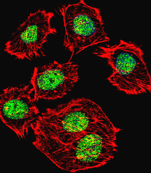 TP53 / p53 Antibody - Fluorescent confocal image of U251 cell stained with p53 Antibody (S315). U251 cells were fixed with 4% PFA (20 min), permeabilized with Triton X-100 (0.1%, 10 min), then incubated with p53 primary antibody (1:25, 1 h at 37°C). For secondary antibody, Alexa Fluor 488 conjugated donkey anti-rabbit antibody (green) was used (1:400, 50 min at 37°C). Cytoplasmic actin was counterstained with Alexa Fluor 555 (red) conjugated Phalloidin (7units/ml, 1 h at 37°C). Nuclei were counterstained with DAPI (blue) (10 ug/ml, 10 min). p53 immunoreactivity is localized to Nucleus significantly.