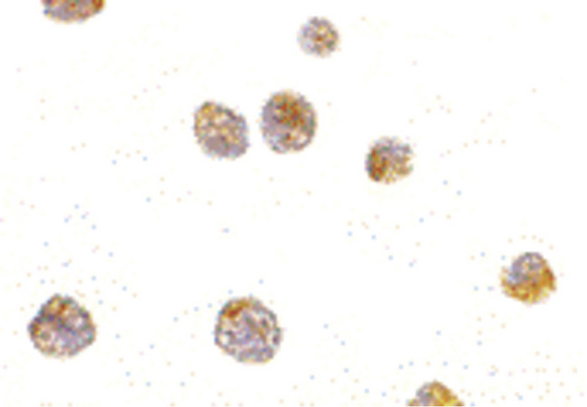 TP53AIP1 / p53 AIP1 Antibody - Immunocytochemistry of p53AIP1 in HL60 cells with p53AIP1 antibody at 10 ug/ml.