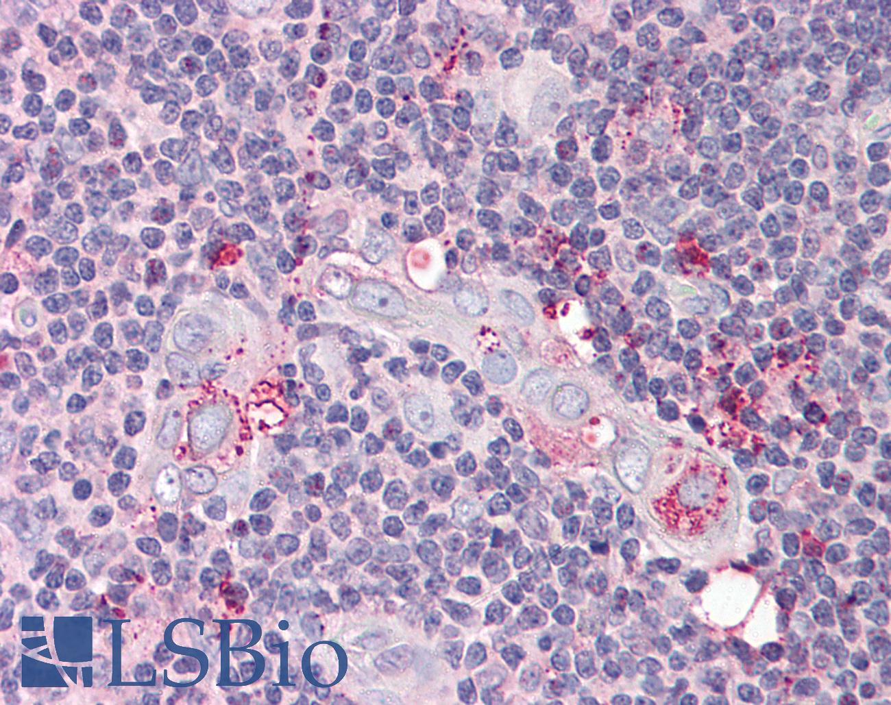 TP53AIP1 / p53 AIP1 Antibody - Anti-TP53AIP1 / p53AIP1 antibody IHC of human thymus. Immunohistochemistry of formalin-fixed, paraffin-embedded tissue after heat-induced antigen retrieval. Antibody concentration 5 ug/ml.