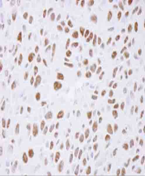 TP53BP1 / 53BP1 Antibody - Detection of Mouse 53BP1 by Immunohistochemistry. Samples: FFPE section of mouse squamous cell carcinoma. Antibody: Affinity purified rabbit anti-53BP1 used at a dilution of 1:500. Detection: DAB.