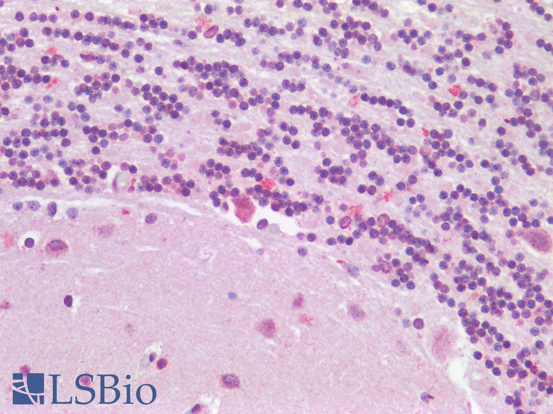 TP53BP1 / 53BP1 Antibody - Human Brain, Cerebellum: Formalin-Fixed, Paraffin-Embedded (FFPE)
