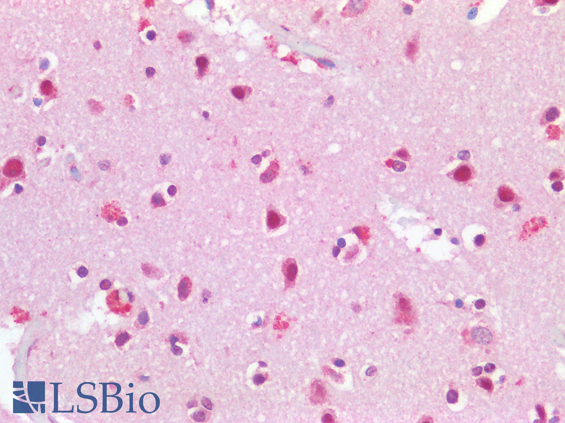 TP53BP1 / 53BP1 Antibody - Human Brain, Cortex: Formalin-Fixed, Paraffin-Embedded (FFPE)