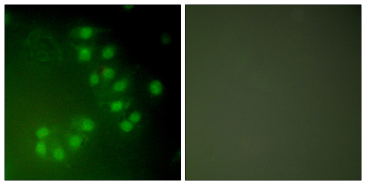 TP63 / p63 Antibody - Immunofluorescence analysis of A549 cells, using p63 Antibody. The picture on the right is blocked with the synthesized peptide.