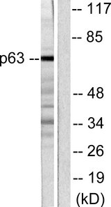 TP63 / p63 Antibody - Western blot analysis of lysates from COS7 cells, using p63 Antibody. The lane on the right is blocked with the synthesized peptide.