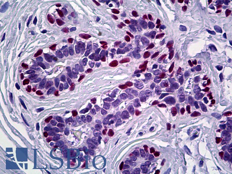 TP63 / p63 Antibody - Anti-p63 antibody IHC staining of human breast. Immunohistochemistry of formalin-fixed, paraffin-embedded tissue after heat-induced antigen retrieval. Antibody dilution 1:200.