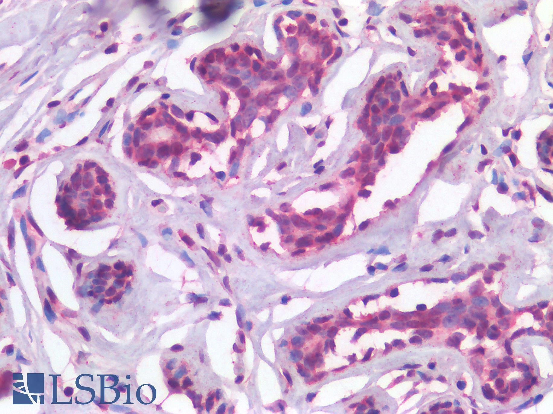 TP63 / p63 Antibody - Human Breast: Formalin-Fixed, Paraffin-Embedded (FFPE)