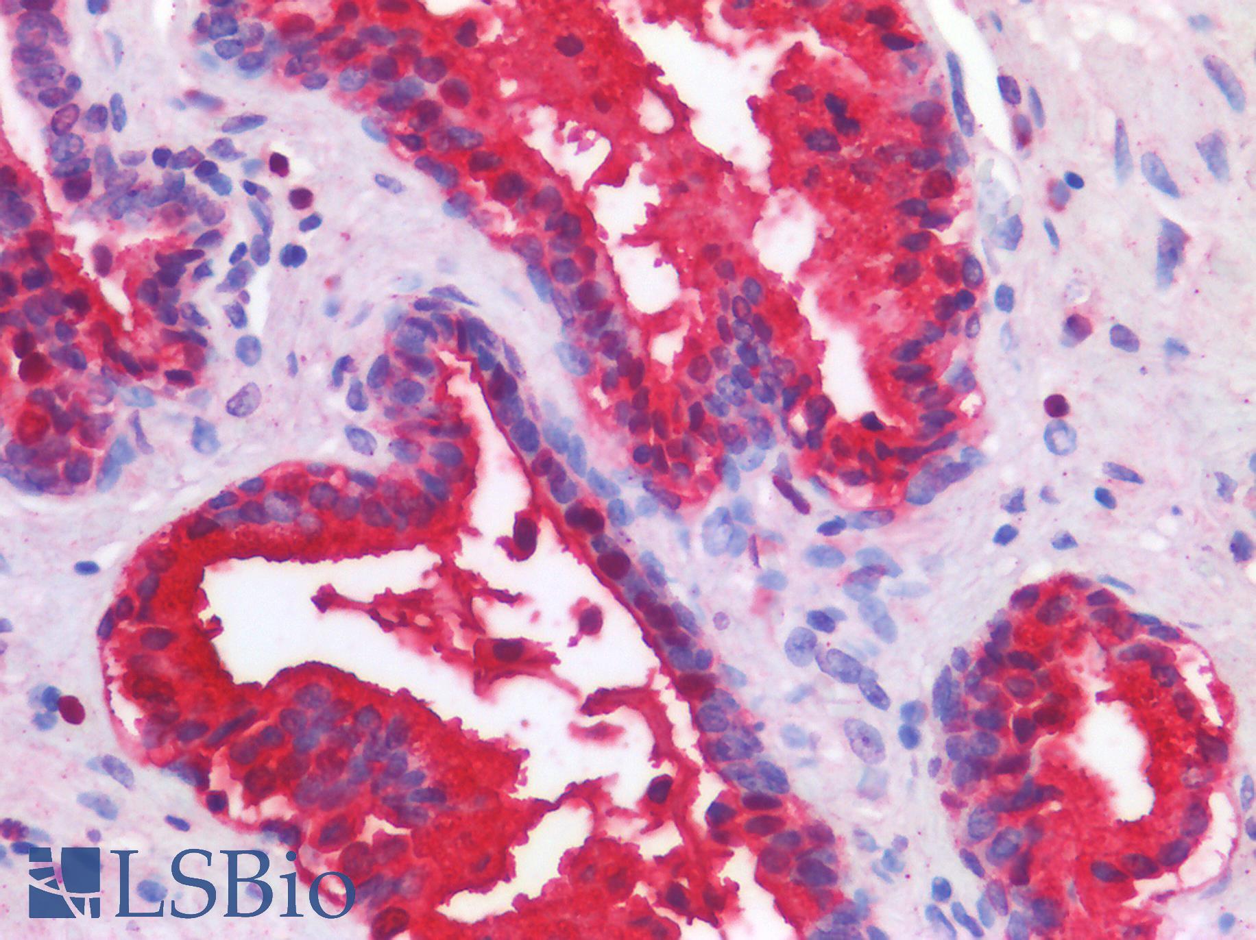 TP63 / p63 Antibody - Human Prostate: Formalin-Fixed, Paraffin-Embedded (FFPE)