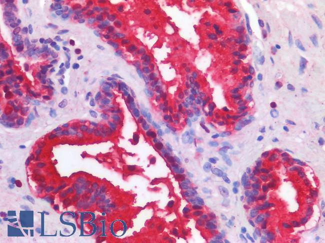 TP63 / p63 Antibody - Human Prostate: Formalin-Fixed, Paraffin-Embedded (FFPE)