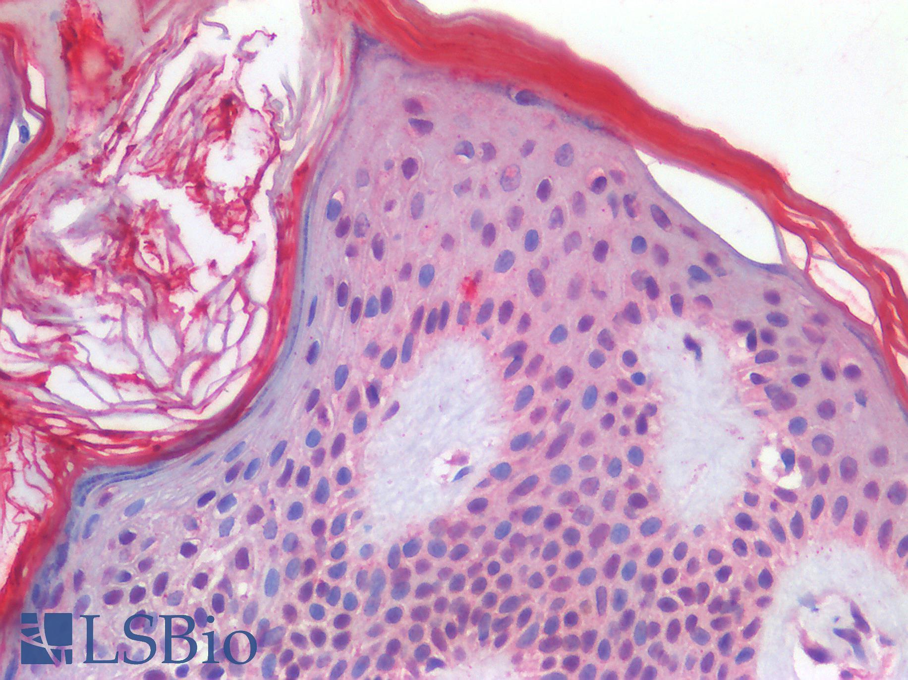 TP63 / p63 Antibody - Human Skin: Formalin-Fixed, Paraffin-Embedded (FFPE)