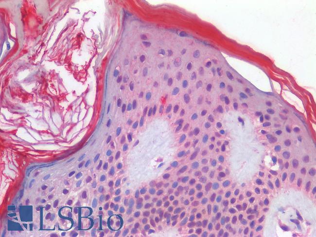 TP63 / p63 Antibody - Human Skin: Formalin-Fixed, Paraffin-Embedded (FFPE)