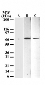 TP73 / p73 Antibody - Western blot analysis for dNp73 using antibody at 1 ug/ml in A) a cell line transfected with dNp73 cDNA, B) HeLa, and C) NIH 3T3 cell lysate.