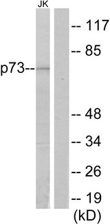 TP73 / p73 Antibody - Western blot analysis of lysates from Jurkat cells, using p73 Antibody. The lane on the right is blocked with the synthesized peptide.