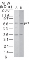TP73 / p73 Antibody - Western blot of p73 in A) transfected cell lysate and B) HeLa cell lysate using antibody at 1 ug/ml.