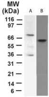 TP73 / p73 Antibody - Western blot of p73 in A) transfected?cell lysate and B) HeLa cell lysate using antibody at 2 ug/ml.
