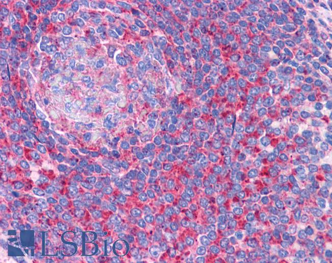 TPD52L2 / HD54 Antibody - Anti-TPD52L2 antibody IHC of human spleen. Immunohistochemistry of formalin-fixed, paraffin-embedded tissue after heat-induced antigen retrieval. Antibody concentration 3.75 ug/ml.