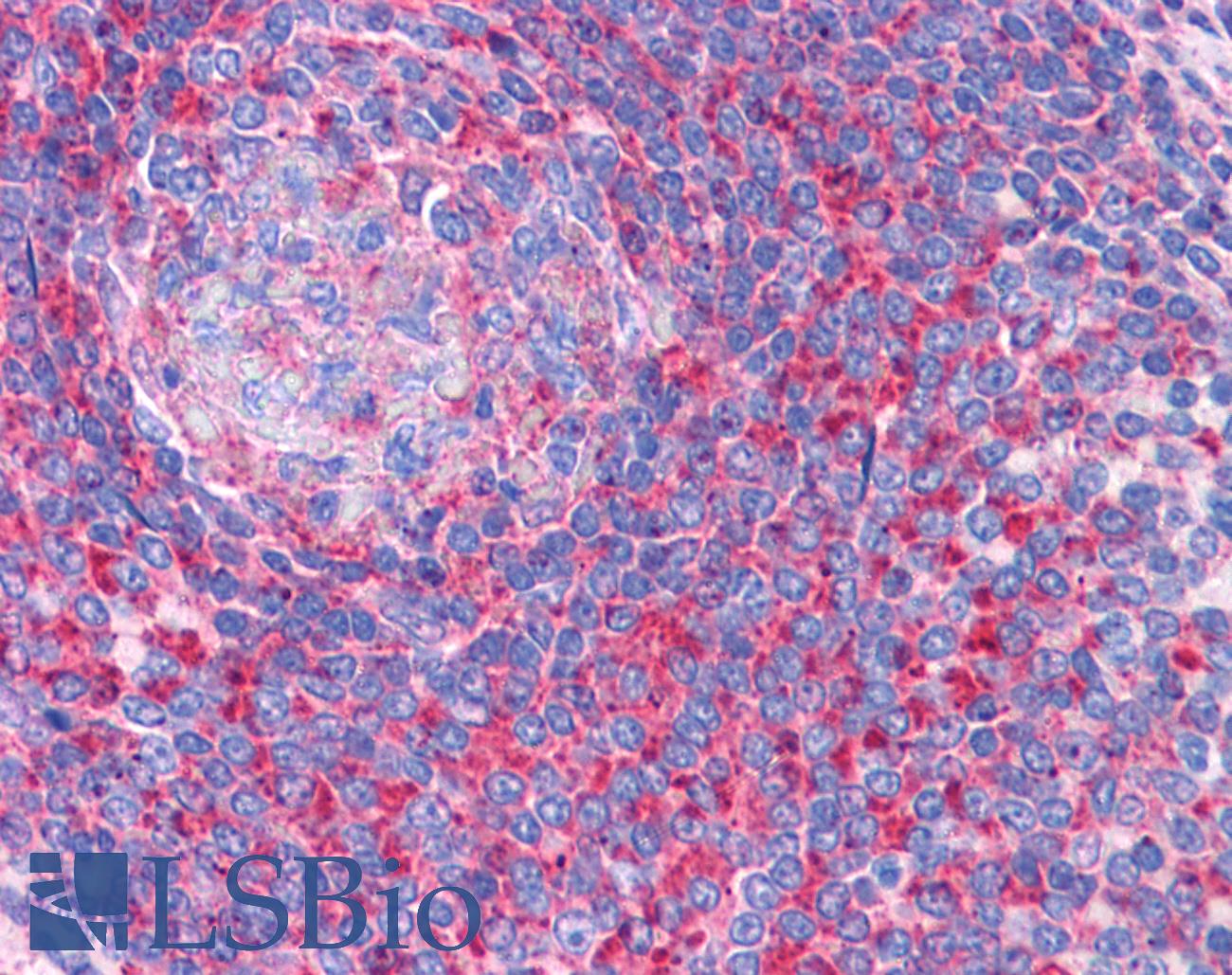 TPD52L2 / HD54 Antibody - Anti-TPD52L2 antibody IHC of human spleen. Immunohistochemistry of formalin-fixed, paraffin-embedded tissue after heat-induced antigen retrieval. Antibody concentration 3.75 ug/ml.