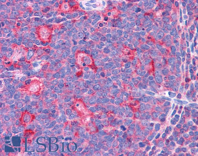 TPD52L2 / HD54 Antibody - Anti-TPD52L2 antibody IHC of human tonsil. Immunohistochemistry of formalin-fixed, paraffin-embedded tissue after heat-induced antigen retrieval. Antibody concentration 3.75 ug/ml.