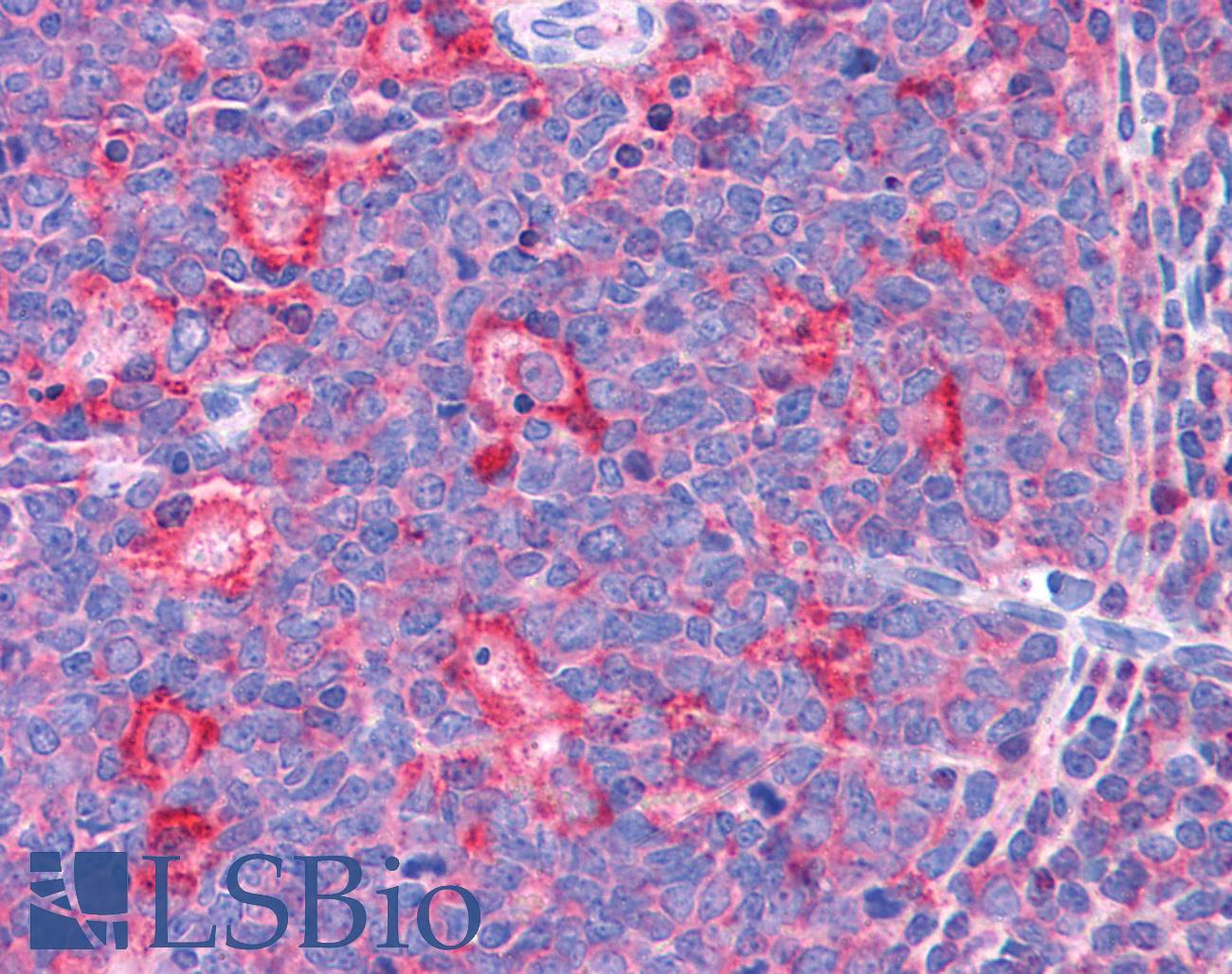TPD52L2 / HD54 Antibody - Anti-TPD52L2 antibody IHC of human tonsil. Immunohistochemistry of formalin-fixed, paraffin-embedded tissue after heat-induced antigen retrieval. Antibody concentration 3.75 ug/ml.