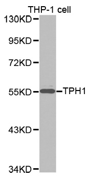 TPH1 / Tryptophan Hydroxylase Antibody - Western blot analysis of extracts of THP-1 cell lines, using TPH1 antibody.
