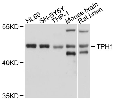 TPH1 / Tryptophan Hydroxylase Antibody - Western blot analysis of extracts of various cell lines, using TPH1 antibody at 1:1000 dilution. The secondary antibody used was an HRP Goat Anti-Rabbit IgG (H+L) at 1:10000 dilution. Lysates were loaded 25ug per lane and 3% nonfat dry milk in TBST was used for blocking. An ECL Kit was used for detection and the exposure time was 10s.