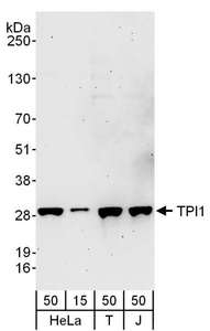 TPI1 / TPI Antibody - Detection of Human TPI1 by Western Blot. Samples: Whole cell lysate from HeLa (15 and 50 ug), 293T (T; 50 ug) and Jurkat (J; 50 ug) cells. Antibodies: Affinity purified rabbit anti-TPI1 antibody used for WB at 0.1 ug/ml. Detection: Chemiluminescence with an exposure time of 3 minutes.