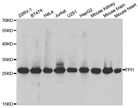 TPI1 / TPI Antibody - Western blot analysis of extracts of various cell lines, using TPI1 antibody.
