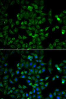 TPI1 / TPI Antibody - Immunofluorescence analysis of HeLa cell using TPI1 antibody. Blue: DAPI for nuclear staining.