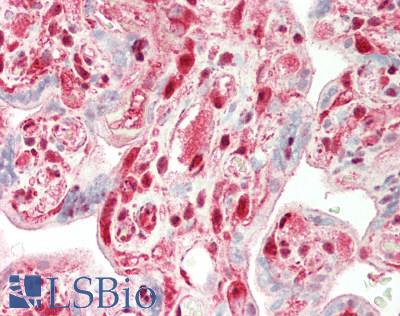 TPI1 / TPI Antibody - Human Placenta: Formalin-Fixed, Paraffin-Embedded (FFPE)
