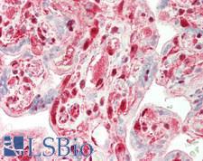 TPI1 / TPI Antibody - Human Placenta: Formalin-Fixed, Paraffin-Embedded (FFPE)
