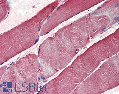 TPI1 / TPI Antibody - Human Skeletal Muscle: Formalin-Fixed, Paraffin-Embedded (FFPE)