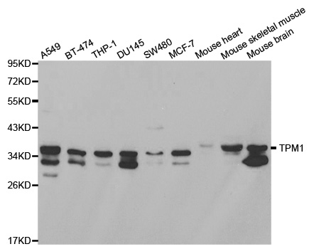 TPM1 / Tropomyosin Antibody - Western blot analysis of extracts of various cell lines, using TPM1 antibody at 1:1000 dilution. The secondary antibody used was an HRP Goat Anti-Rabbit IgG (H+L) at 1:10000 dilution. Lysates were loaded 25ug per lane and 3% nonfat dry milk in TBST was used for blocking.