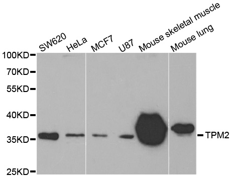 TPM2 Antibody - Western blot analysis of extracts of various cell lines.