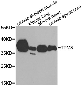 TPM3 Antibody - Western blot analysis of extracts of various tissues, using TPM3 antibody.