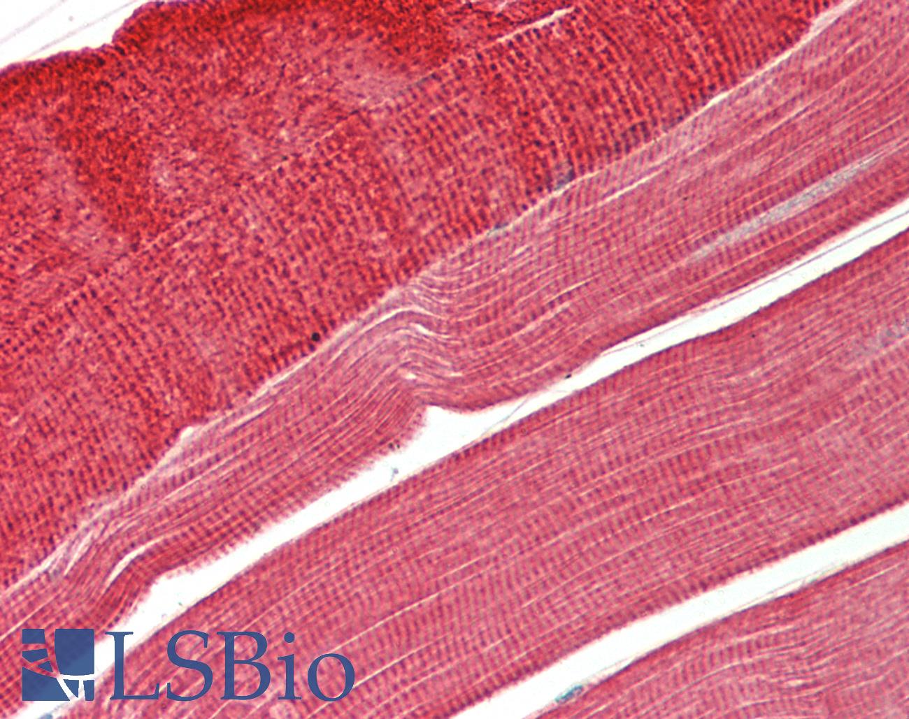 TPM3 Antibody - Human Skeletal Muscle: Formalin-Fixed, Paraffin-Embedded (FFPE)