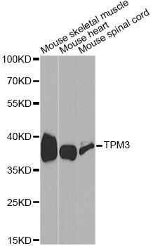 TPM3 Antibody - Western blot analysis of extracts of various cell lines, using TPM3 antibody at 1:1000 dilution. The secondary antibody used was an HRP Goat Anti-Rabbit IgG (H+L) at 1:10000 dilution. Lysates were loaded 25ug per lane and 3% nonfat dry milk in TBST was used for blocking.