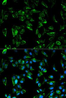 TPM3 Antibody - Immunofluorescence analysis of HeLa cells using TPM3 antibody. Blue: DAPI for nuclear staining.