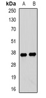 TPM3 Antibody - Western blot analysis of Tropomyosin 3 expression in mouse lung (A); mouse heart (B) whole cell lysates.