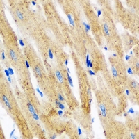 TPM3 Antibody - Immunohistochemical analysis of Tropomyosin 3 staining in mouse heart formalin fixed paraffin embedded tissue section. The section was pre-treated using heat mediated antigen retrieval with sodium citrate buffer (pH 6.0). The section was then incubated with the antibody at room temperature and detected using an HRP conjugated compact polymer system. DAB was used as the chromogen. The section was then counterstained with hematoxylin and mounted with DPX.